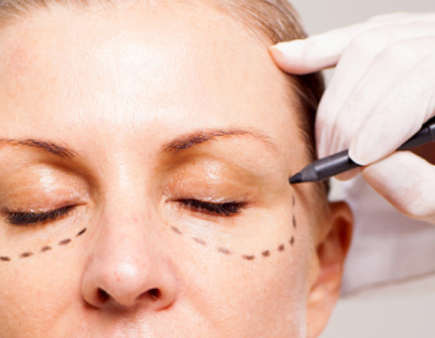 Oculoplastic Eyelid Orbit Surgery in India